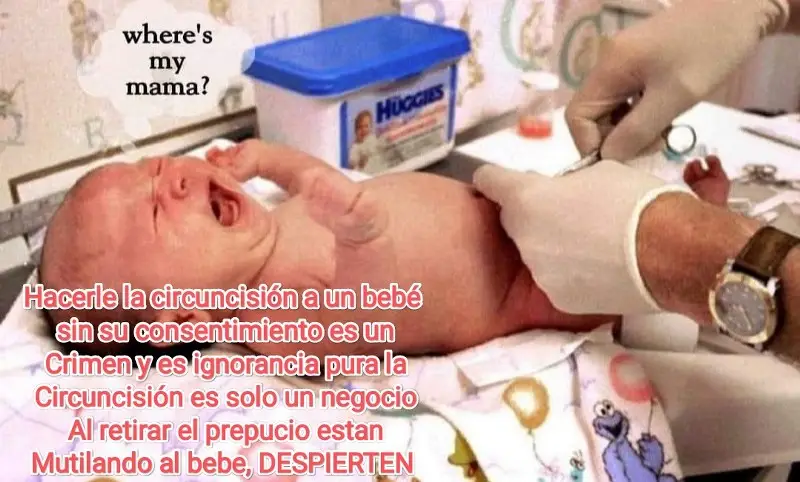 circuncision ya no se hace