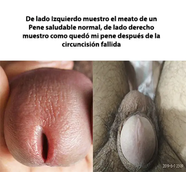 dra rosa estela romero aguilar jalisco mexico